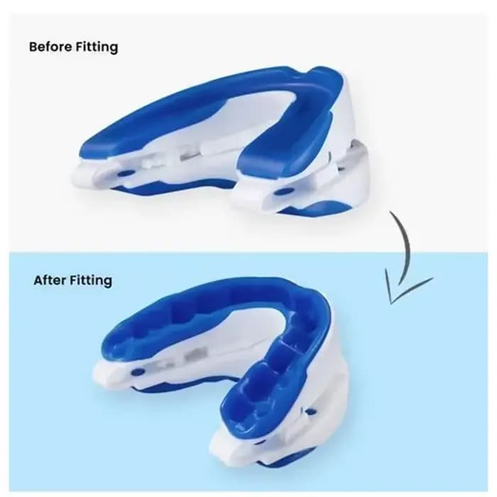 Embouchure Anti-ronflement