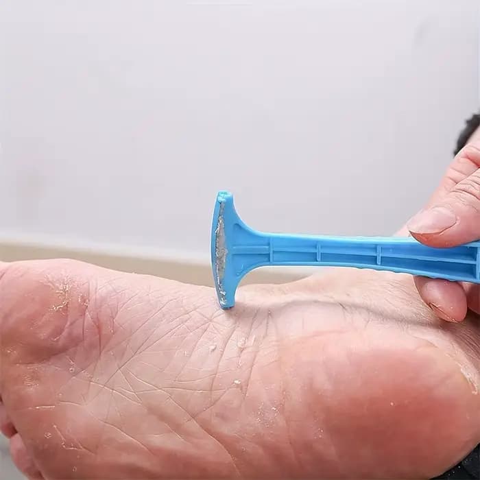 Dissolvant de callosités du talon du pied