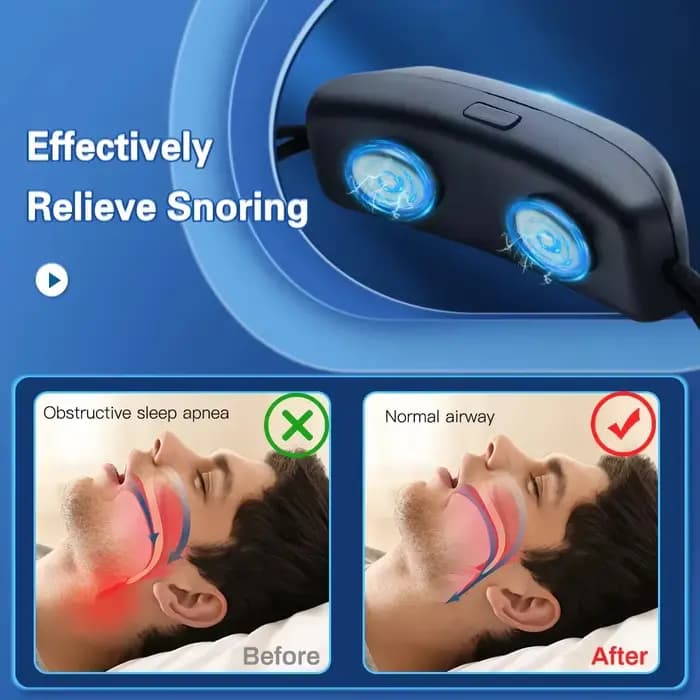 Dispositif anti-ronflement intelligent EMS à impulsions