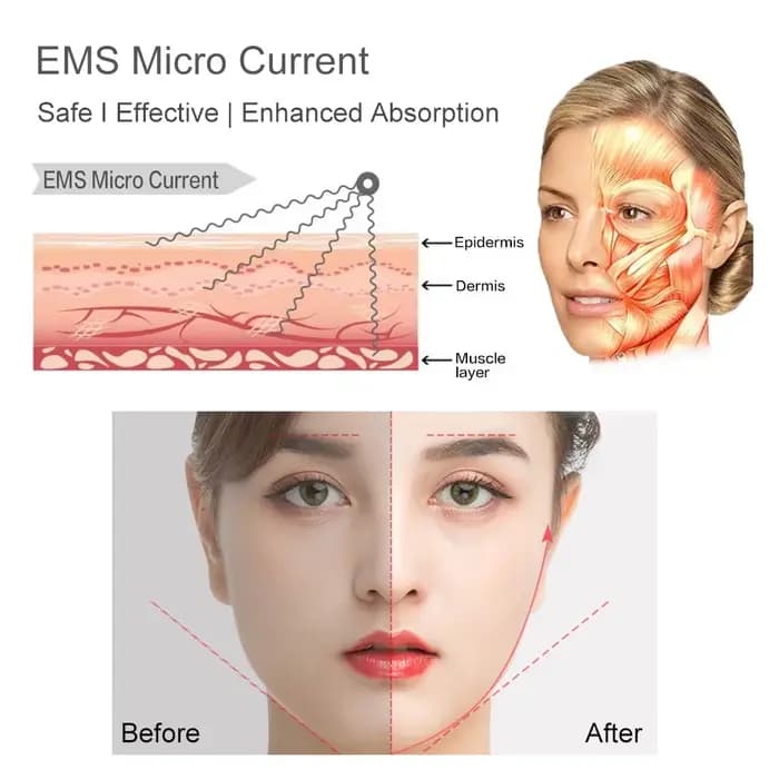 Coussinets d'électrodes de stimulateur musculaire Tens EMS