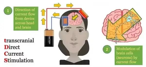 9128H Nouveau Design TDCS Médical pour Améliorer la Mémoire