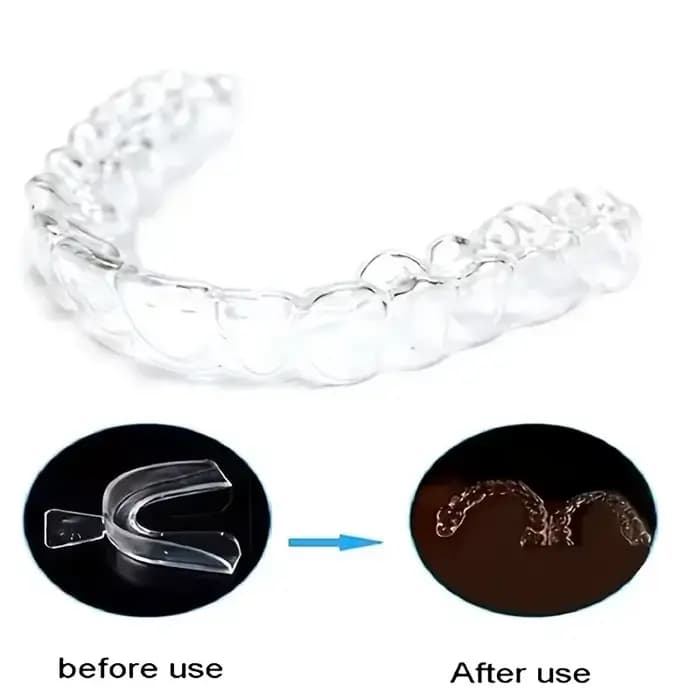 Protections nocturnes dentaires thermoplastiques