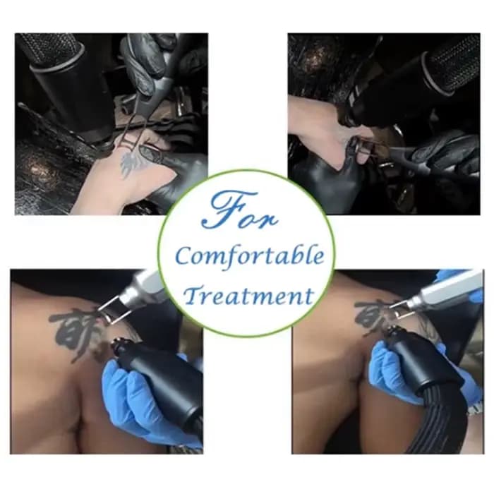 Machine de cryothérapie pour traitement de tatouage